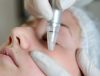 A Guide to Achieving Facial Rejuvenation Through Expert Care